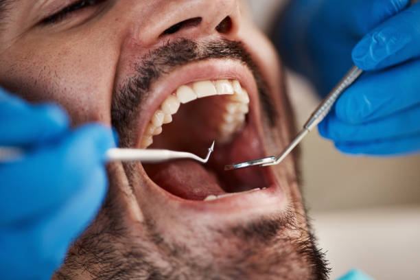Best Emergency Root Canal Treatment in Cusseta, GA